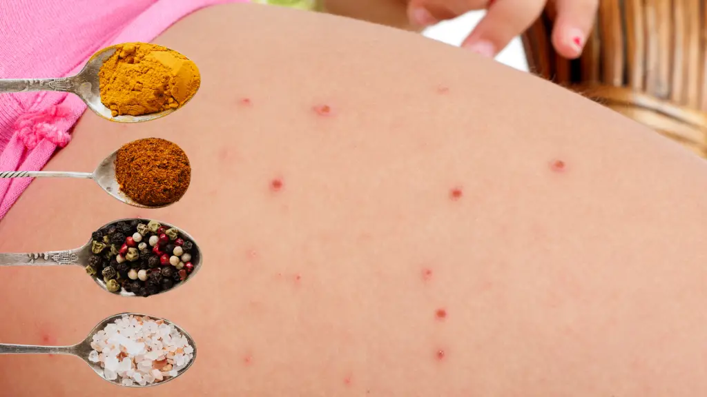 folliculitis-foods-you-need-to-avoid