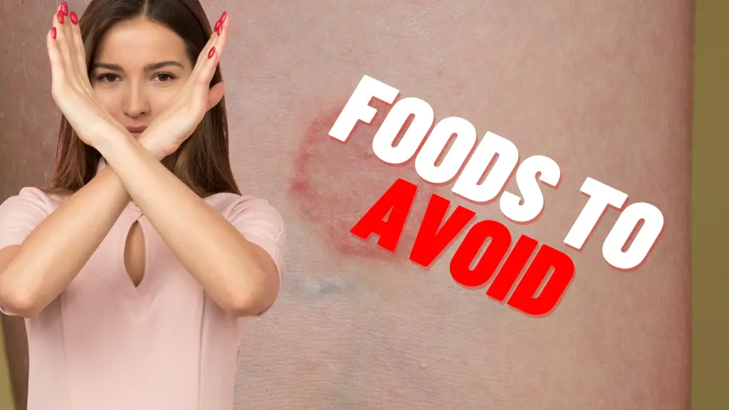 foods-to-avoid-with-lichen-sclerosus