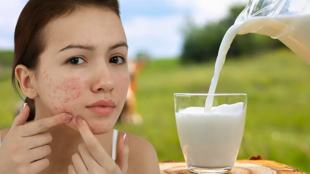 milk alternatives for acne